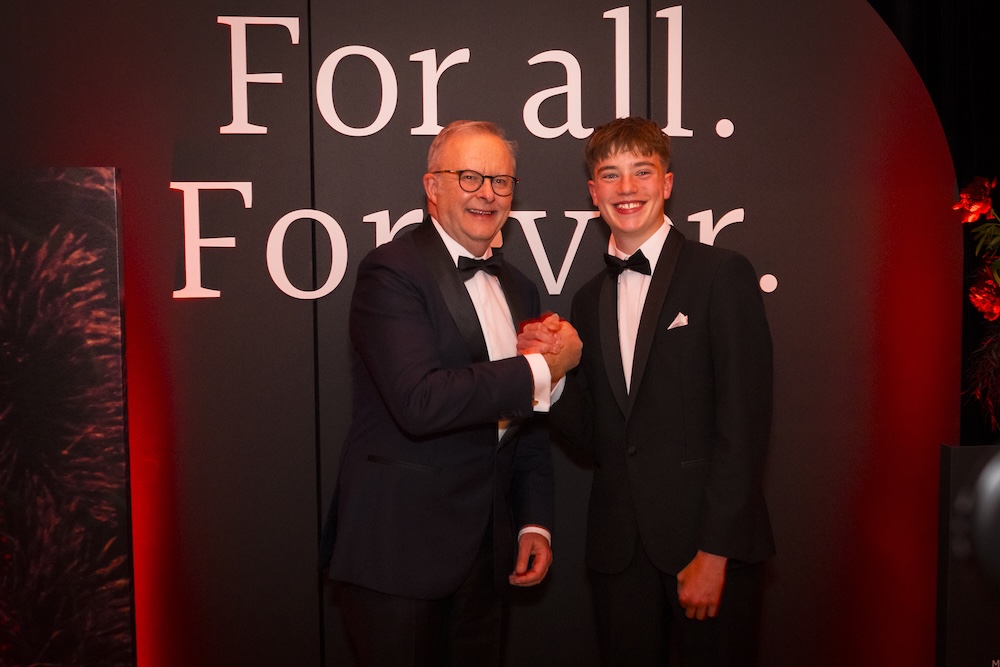 Prime Minister Anthony Albanese and James, 16, who lives with hypoplastic left heart syndrome.